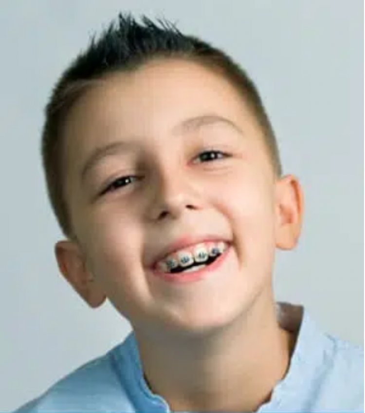 Early Orthodontics Treatment For Children