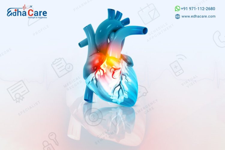 Cardiology Doctors in India