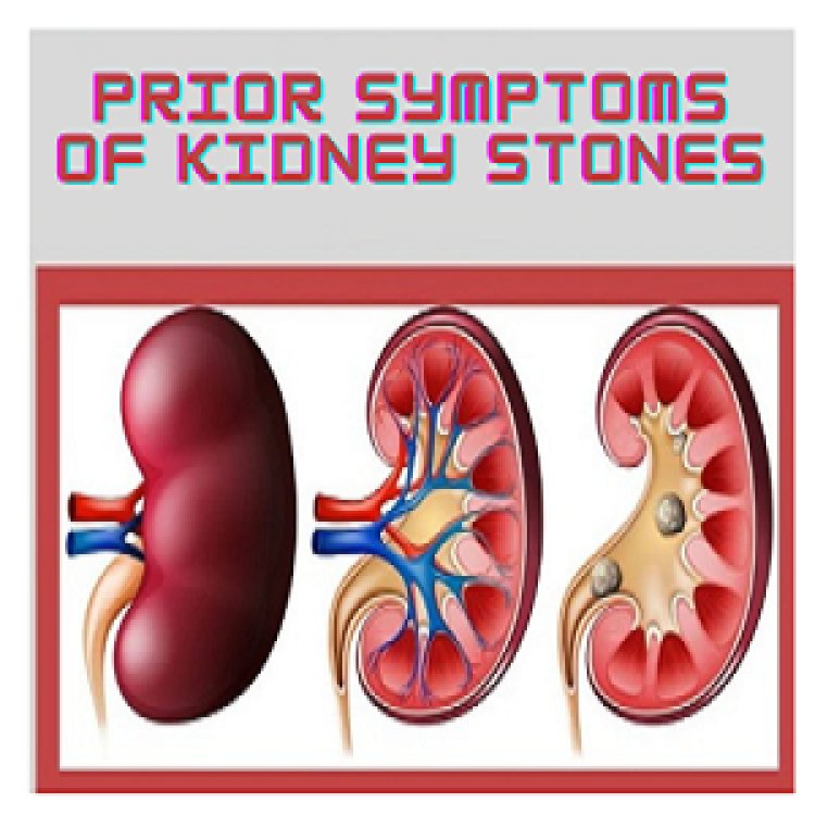 Early signs of kidney stones