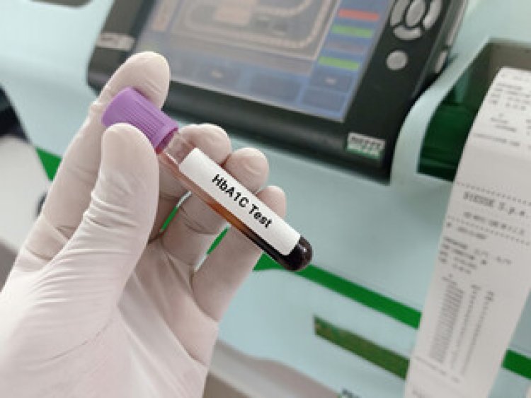 Everything You Should Know About HBA1C Test