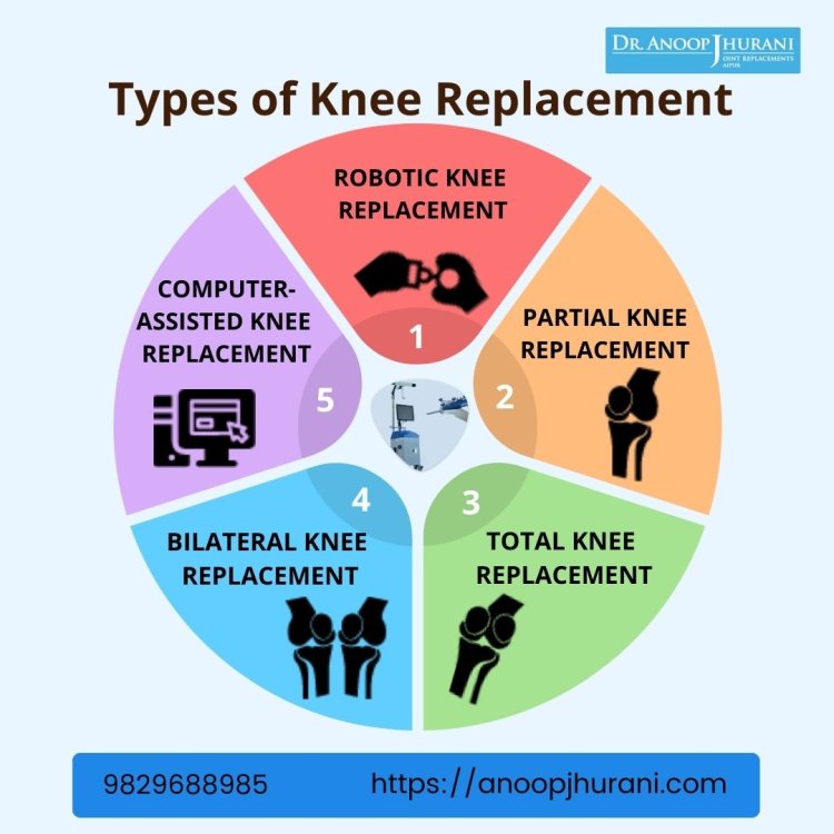 Types of Knee Replacement Surgery and Which One to Choose