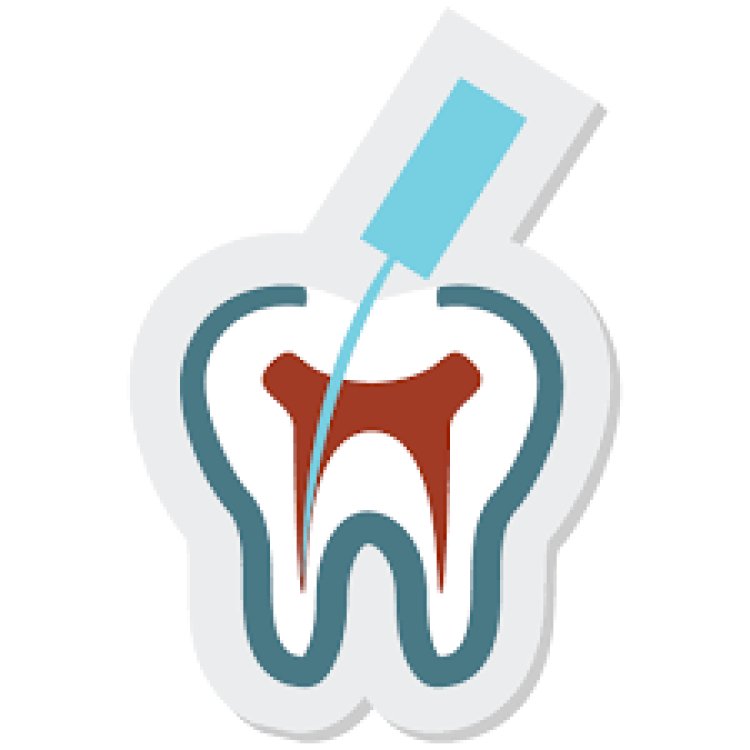 Root canal treatment service provider in kukatpally hyderabad