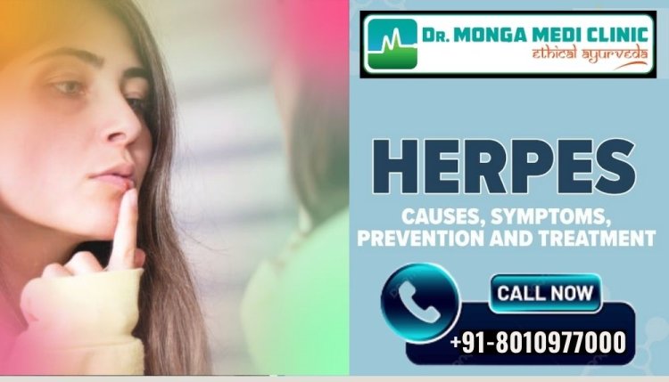 Herpes Doctor Specialist in Delhi NCR PH: 8010977000