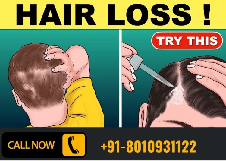 Best Hair doctor in Dwarka Delhi PH: 8010931122