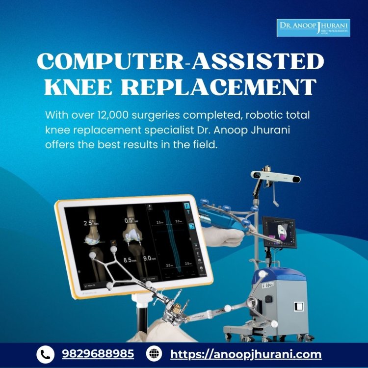 Computer-Assisted Knee Replacement Surgery