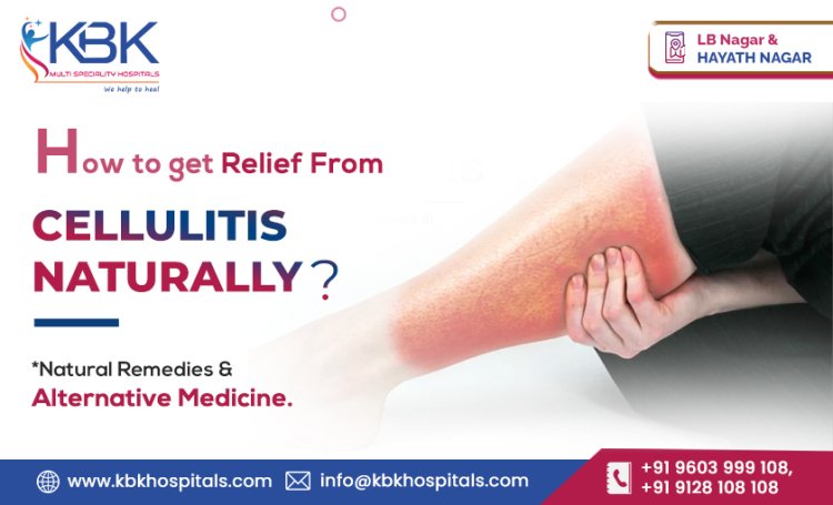 How To Get Relief From Cellulitis Naturally? Natural Remedies & Alternative Medicine | Cellulitis Treatment in Hyderabad