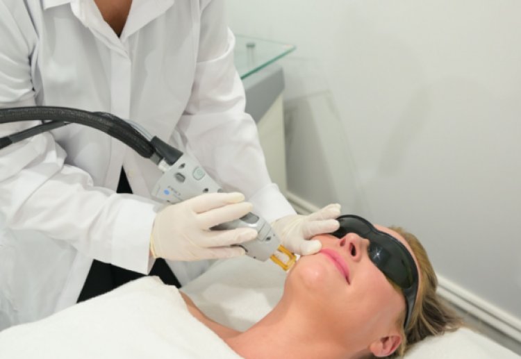 Laser Face Facial Treatment in Essendon