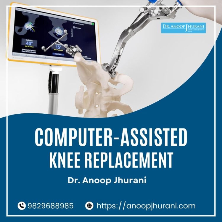 Benefits of Computer-Assisted Knee Replacement Surgery