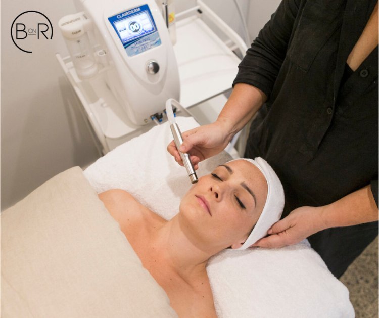 Laser facial treatment in Essendon