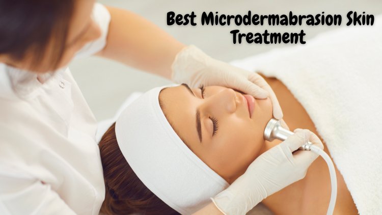 Benefits of Microdermabrasion for Flawless Skin
