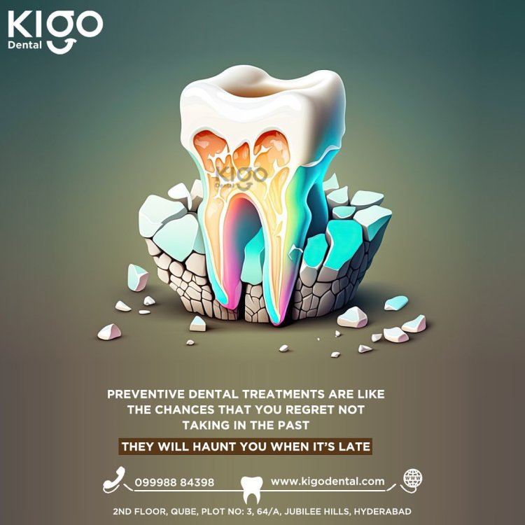 Hyderabad's Premier Dental Hospital – Kigo Dental