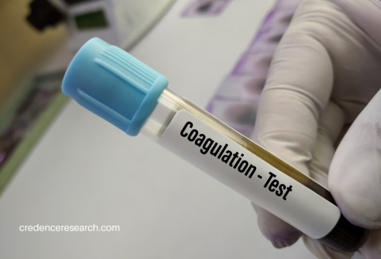 Blood Coagulation Testing Market - Key Players, Growth and Opportunities 2030 | Credence Research