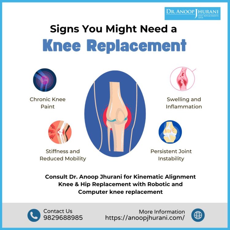 Signs You Might Need a Knee Replacement