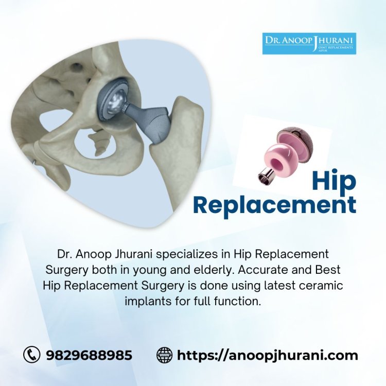 Signs You Might Need a Hip Arthroplasty and the Benefits of Hip Surgery