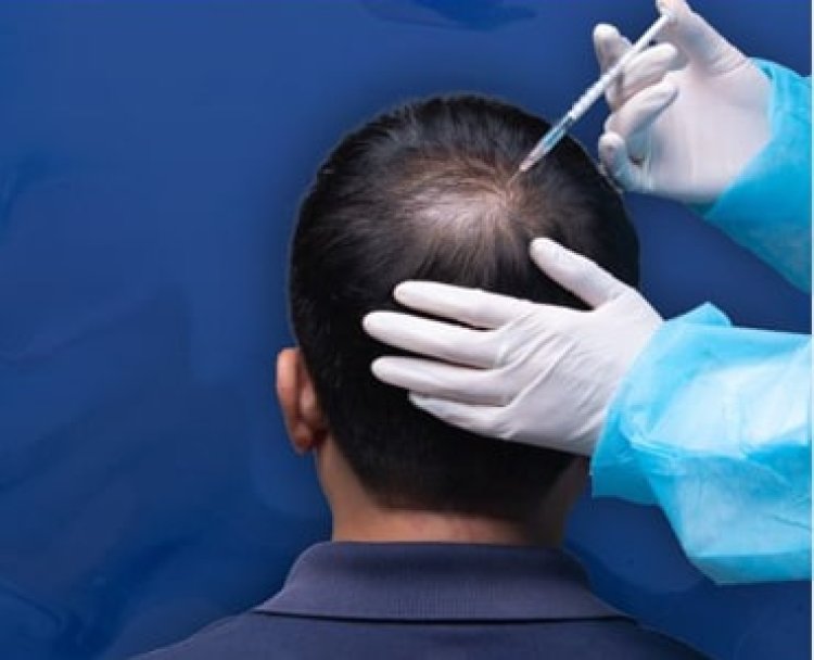 Best hair loss treat ment in bangalore- Hair loss treatment - Hair fall treatment - hair doctor near me - gfc treatment for hair