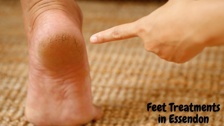Revitalize Your Tired Feet: Effective Treatments to Try Today