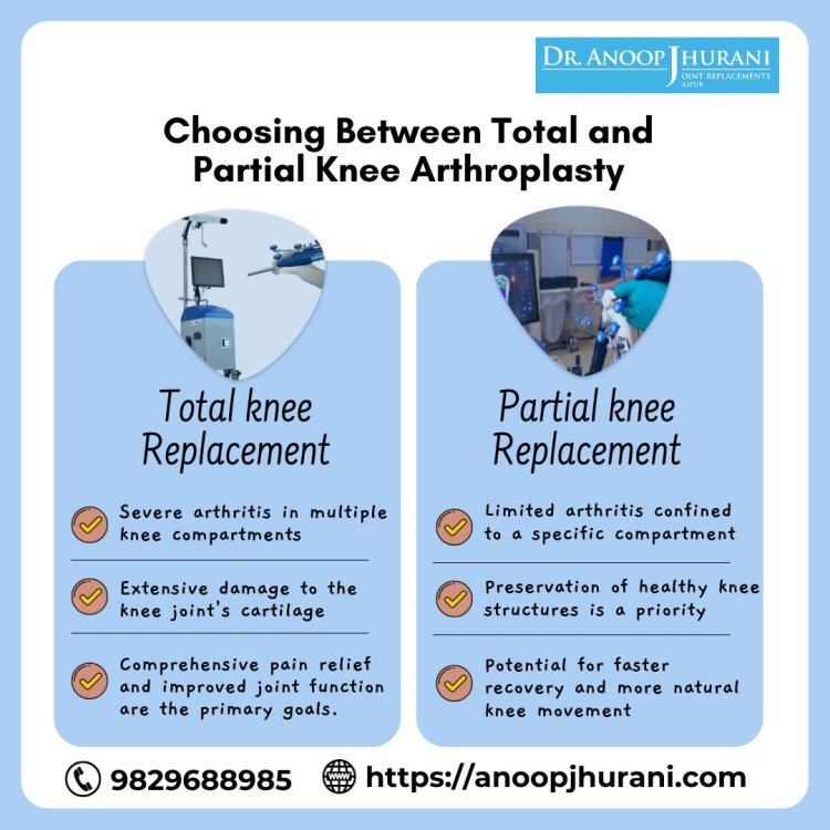 Choosing Between Total and Partial Knee Arthroplasty