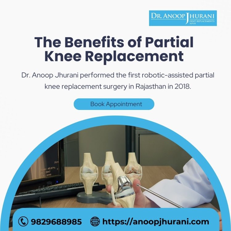 The Benefits of Partial Knee Replacement