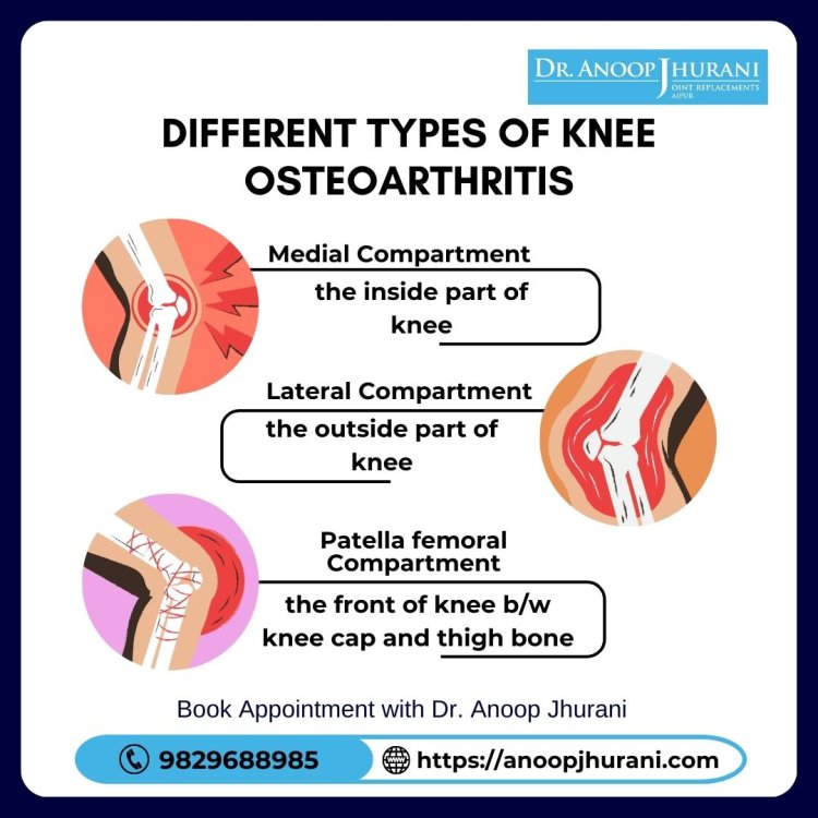 Different types of knee osteoarthritis