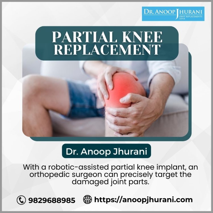 The Steps of a Partial Knee Replacement Procedure