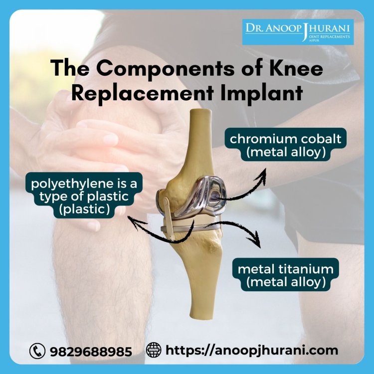The Components of Knee Replacement Implant