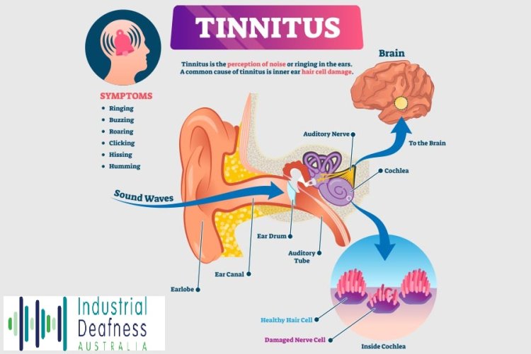 Noise Induced Hearing Loss