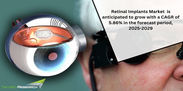 Unveiling Opportunities in the Retinal Implants Industry