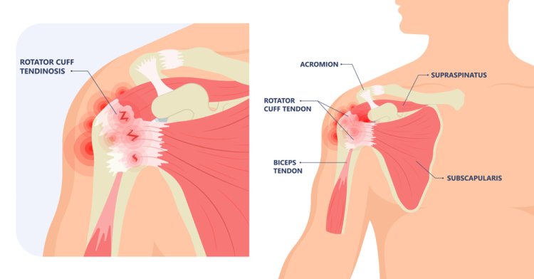 Dr. Shekhar Srivastav: Best Arthroscopy Surgeon in Delhi