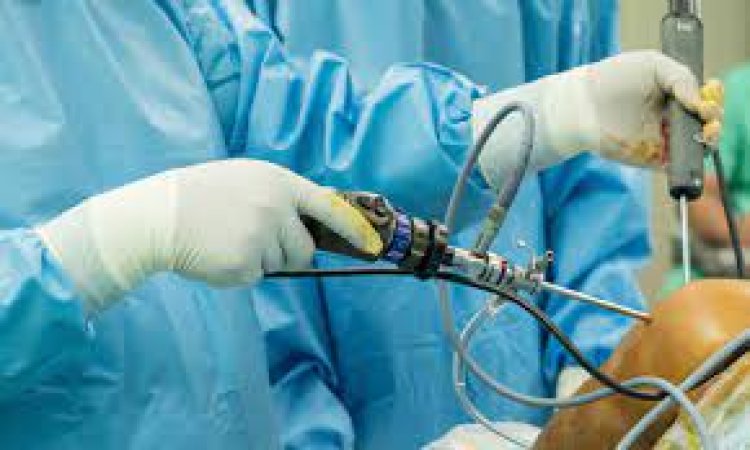 Meet Dr. Shekhar Srivastav: The Best Arthroscopy Surgeon in Delhi