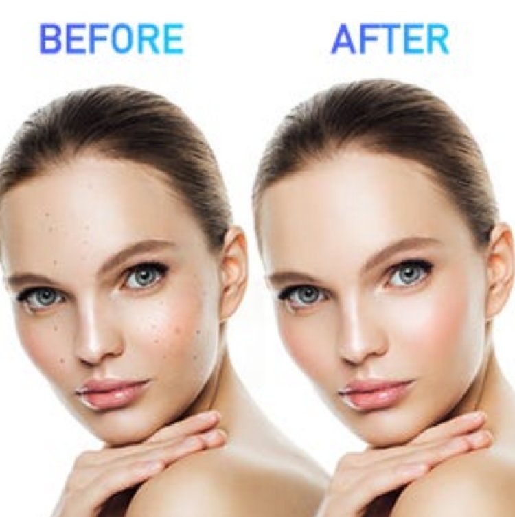 Skin Fix US - Eliminate Wrinkles And Get Glowing & Shiny Skin!
