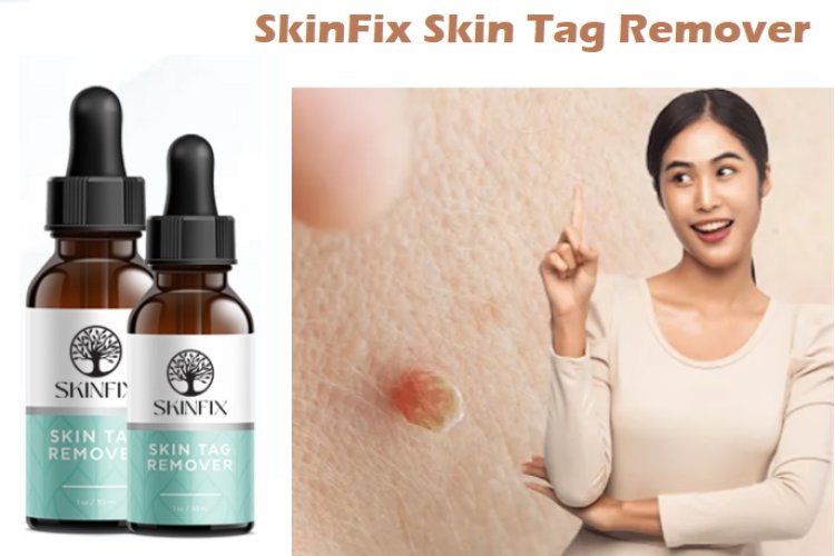 SkinFix Skin Tag Remover USA Price - How Does It Work Or Hoax?