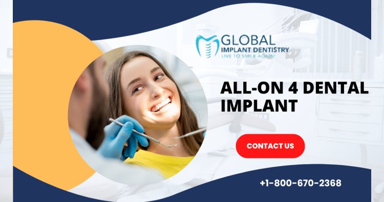 Revolutionize Your Smile with All-On-4 Dental Implant Services in Tustin, CA by Global Implant Dentistry: Transforming Lives with Advanced Dental Solutions