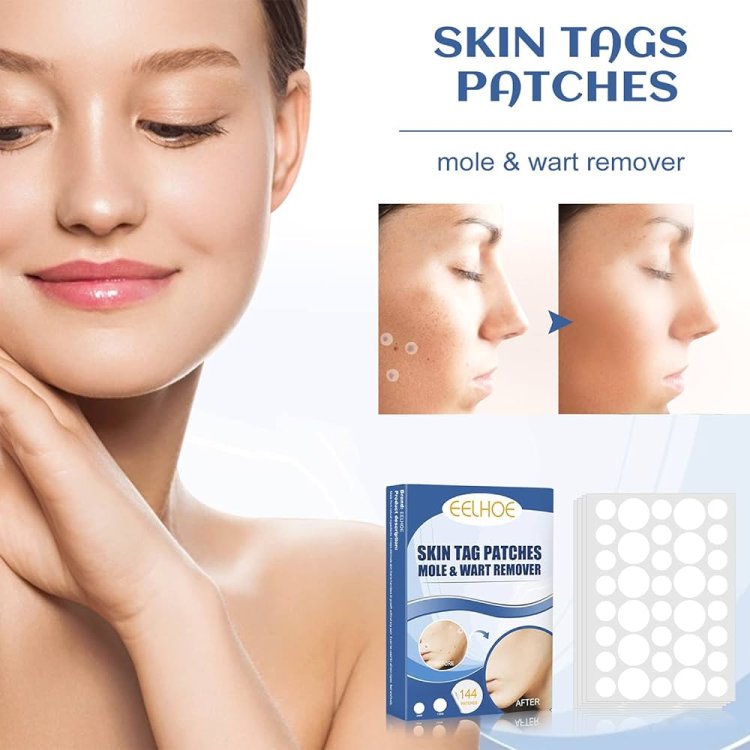 Skin Fix Tag Remover How to Use & Where to Buy?