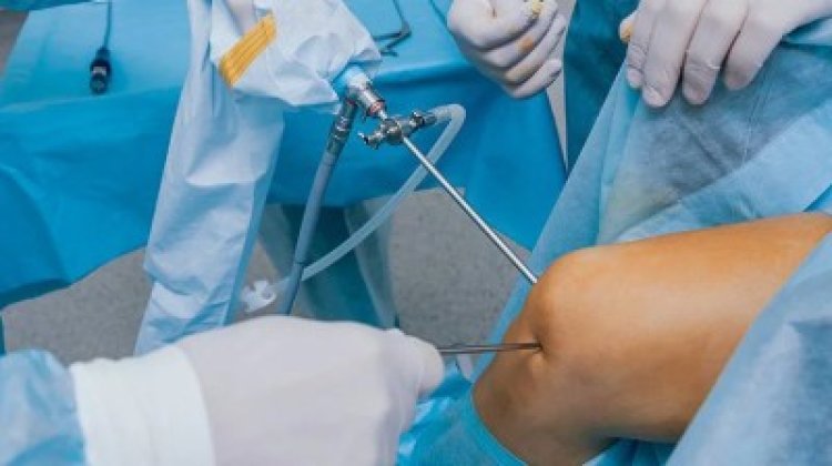 Expert Arthroscopic Knee Surgery in Delhi by Dr. Shekhar Srivastav