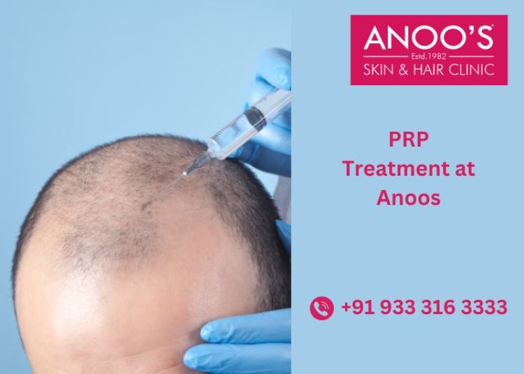 Advanced PRP Treatment at Anoos