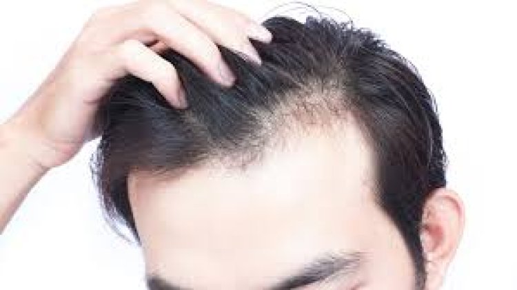 Hair Loss Consultations Demystified: Understanding the Process and Benefits
