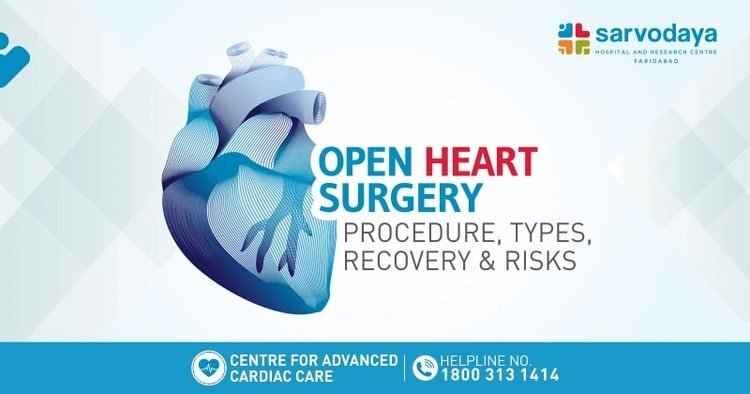 Open Heart Surgery - Procedure, Types, Recovery & Risks