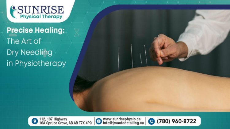 Dry Needling Therapy in Spruce Grove: Relieving Pain and Restoring Function