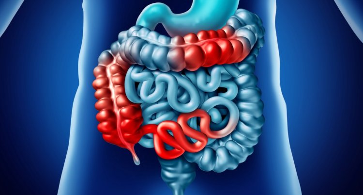 Crohn’s Disease Treatment Market Analysis, Size, Share, Trends, Growth And Forecast To 2033