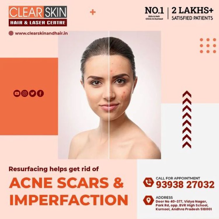 best laser treatment clinic in india