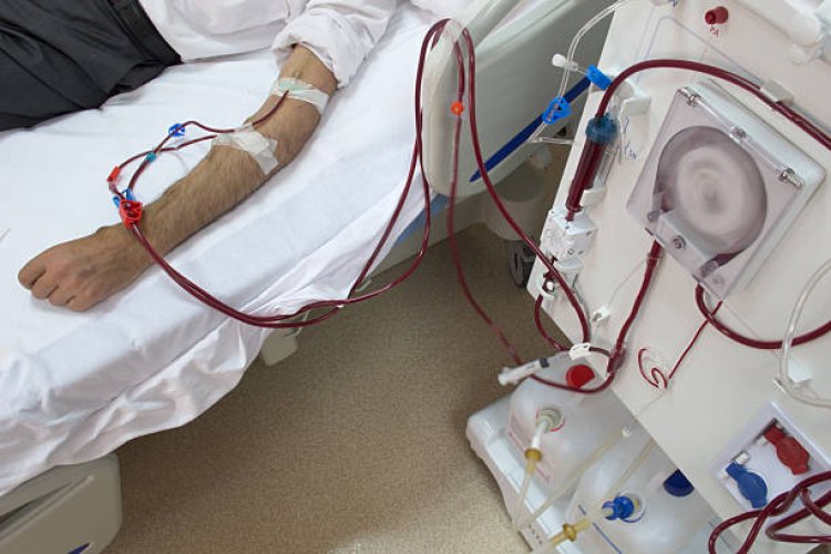 Hemodialysis Global Market 2024 - By Size, Demand, Share, Trends, Forecast To 2033