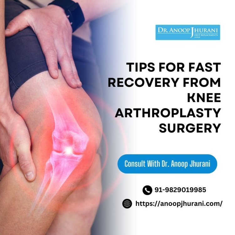 Tips for Fast Recovery from Knee Arthroplasty Surgery