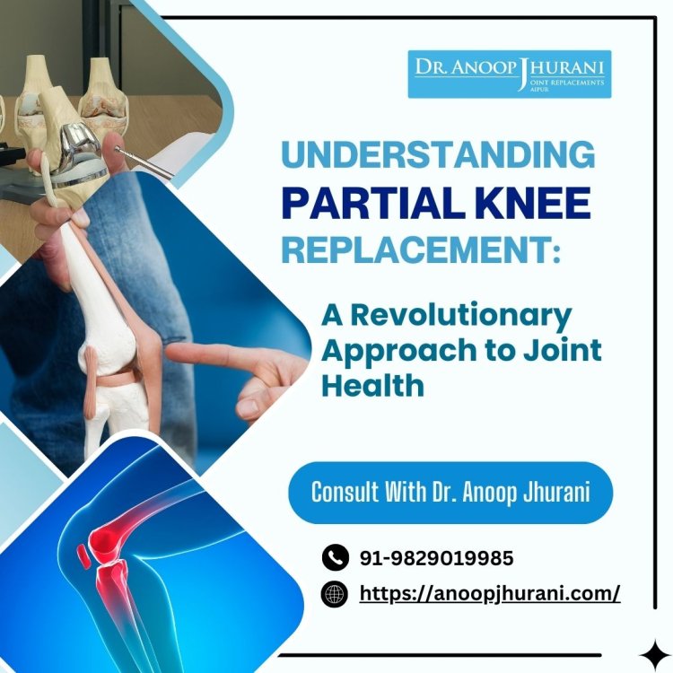 Understanding Partial Knee Replacement