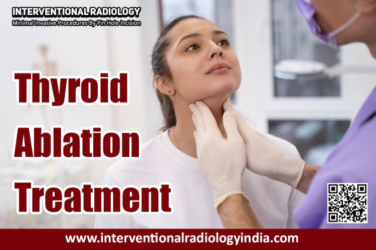 Considering Thyroid Ablation Treatment in Delhi?