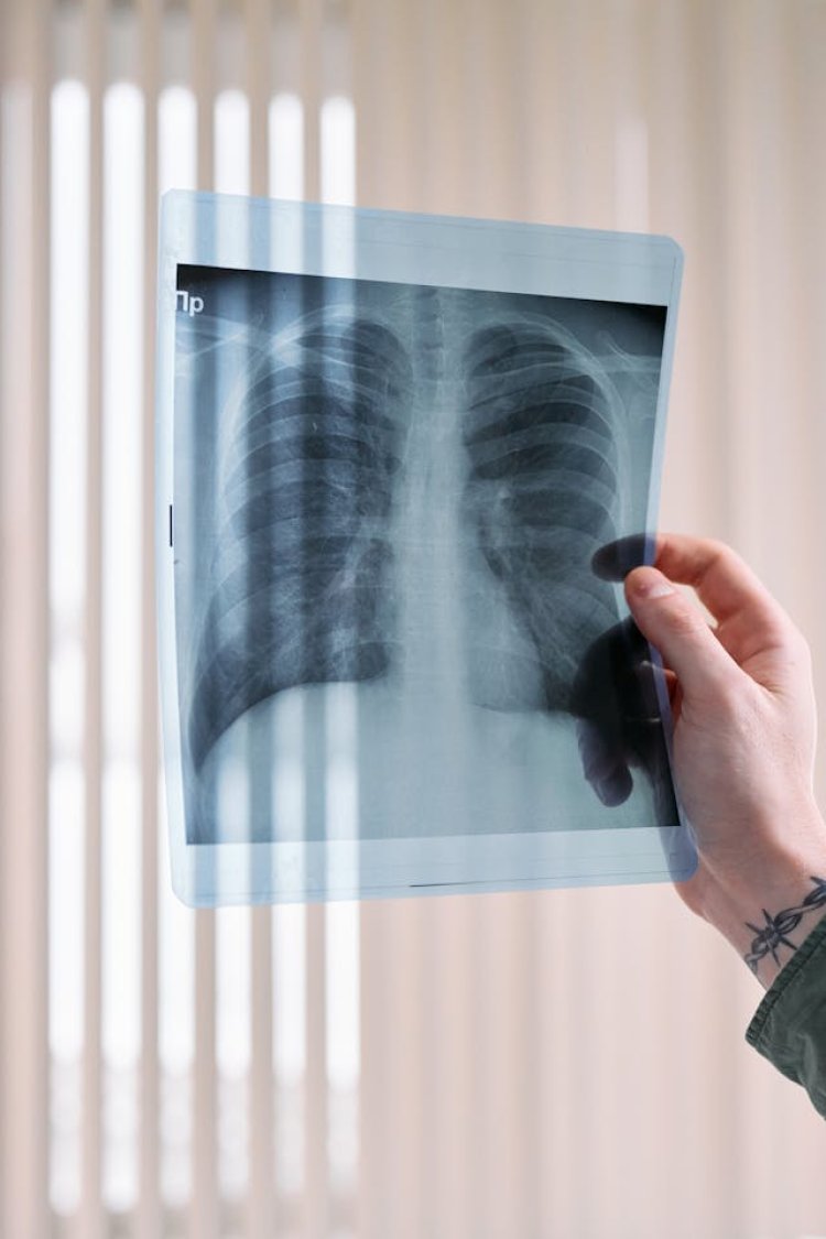 Global Lung Cancer Diagnostic And Screening Market Report 2024: Market Size, CAGR, Lucrative Segments