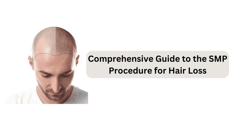 Comprehensive Guide to the SMP Procedure for Hair Loss