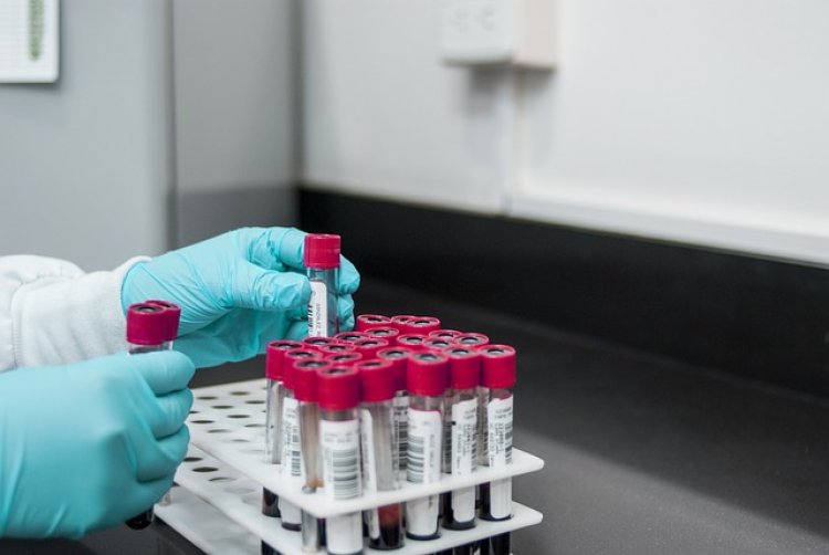 Lateral Flow Immunoassay (LFIA) Based Rapid Test Global Market Anticipated to Attain $7.79 Billion at a CAGR of -1.6%  By 2028