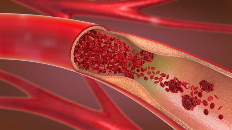 Vascular Grafts Market: Outlook, Overview, Major Key Players And Industry Analysis Till 2033