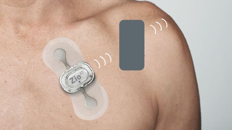 Wearable ECG Monitors Market Size, Share, Regional Overview And Global Forecast To 2033
