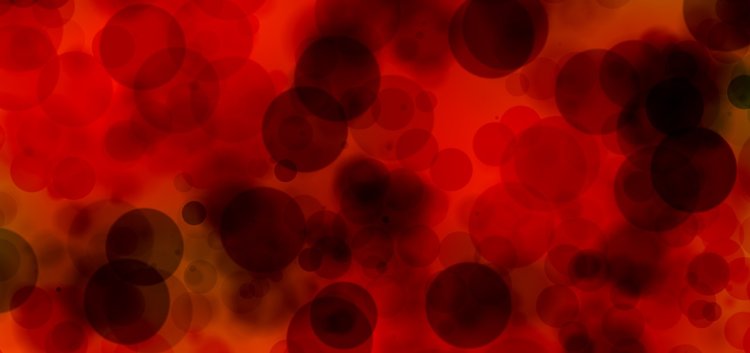 Acute Myeloid Leukemia Market Report 2024 Size, Share and Segment Analysis 2033